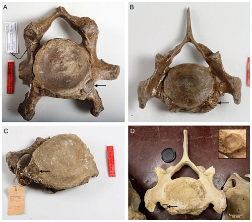 Cervical ribs in mammals – why it matters